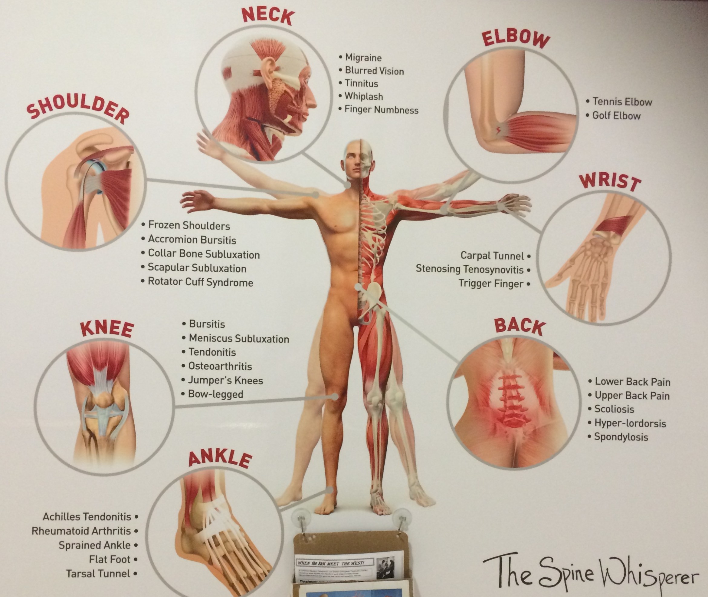 The Spine Whisperer_POMO (3)